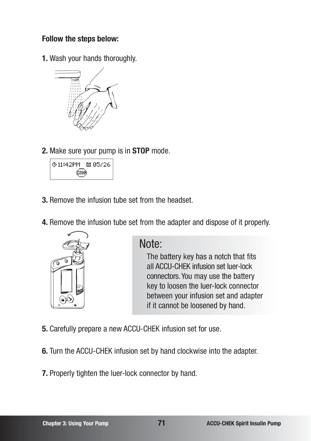 Accu-Chek insulin pump manual Follow the steps below 