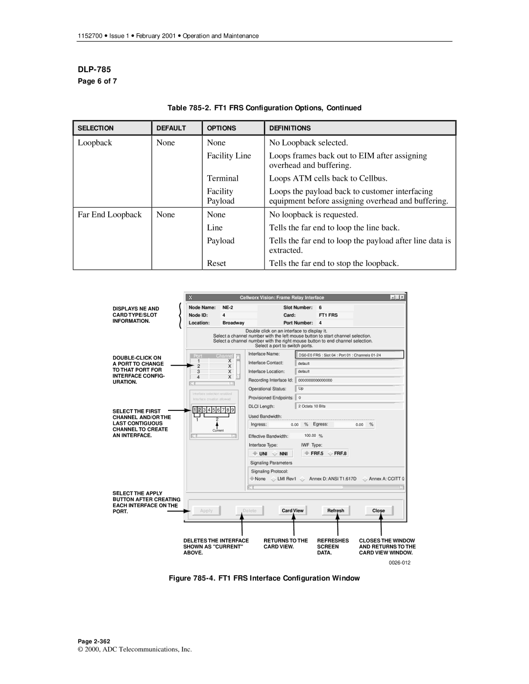 ADC Release 3.1 user manual FT1 FRS Interface Configuration Window 