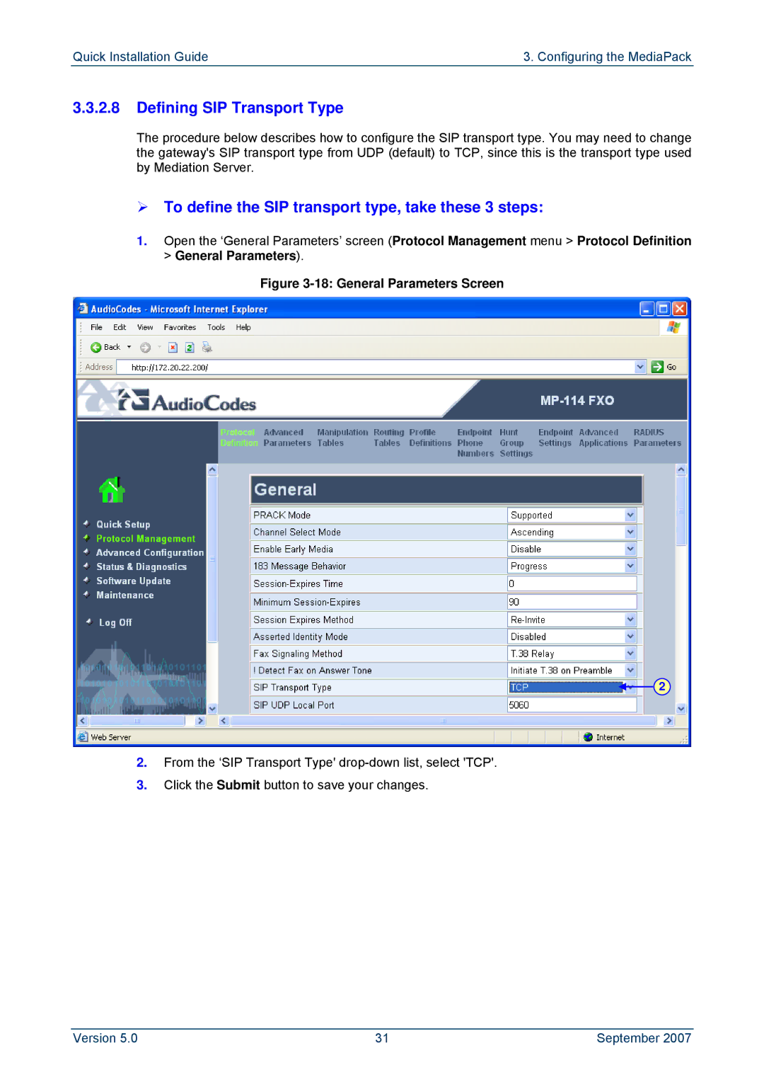 ADTRAN MP-114, MP-118 manual Defining SIP Transport Type, ¾ To define the SIP transport type, take these 3 steps 