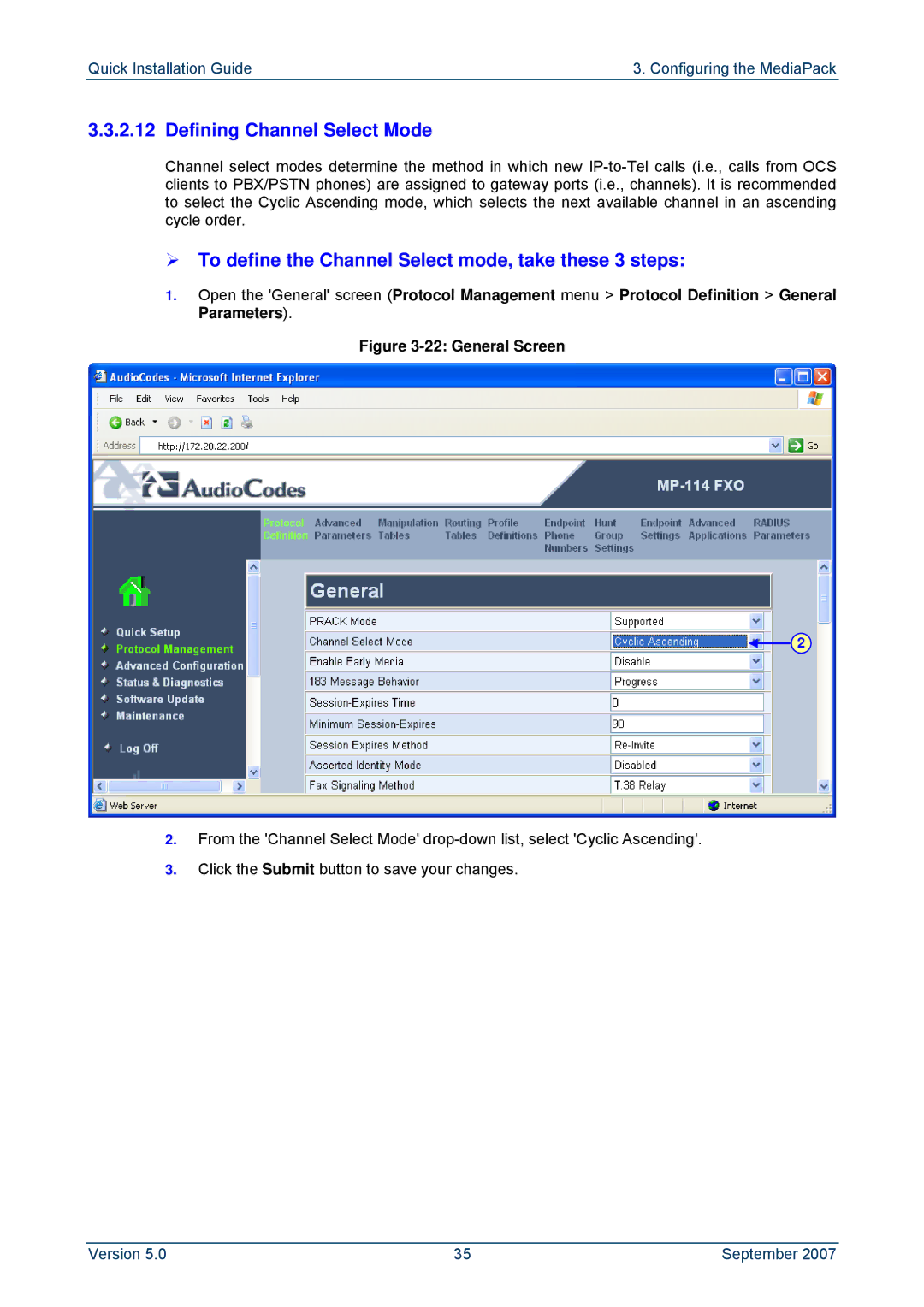 ADTRAN MP-114, MP-118 manual Defining Channel Select Mode, ¾ To define the Channel Select mode, take these 3 steps 