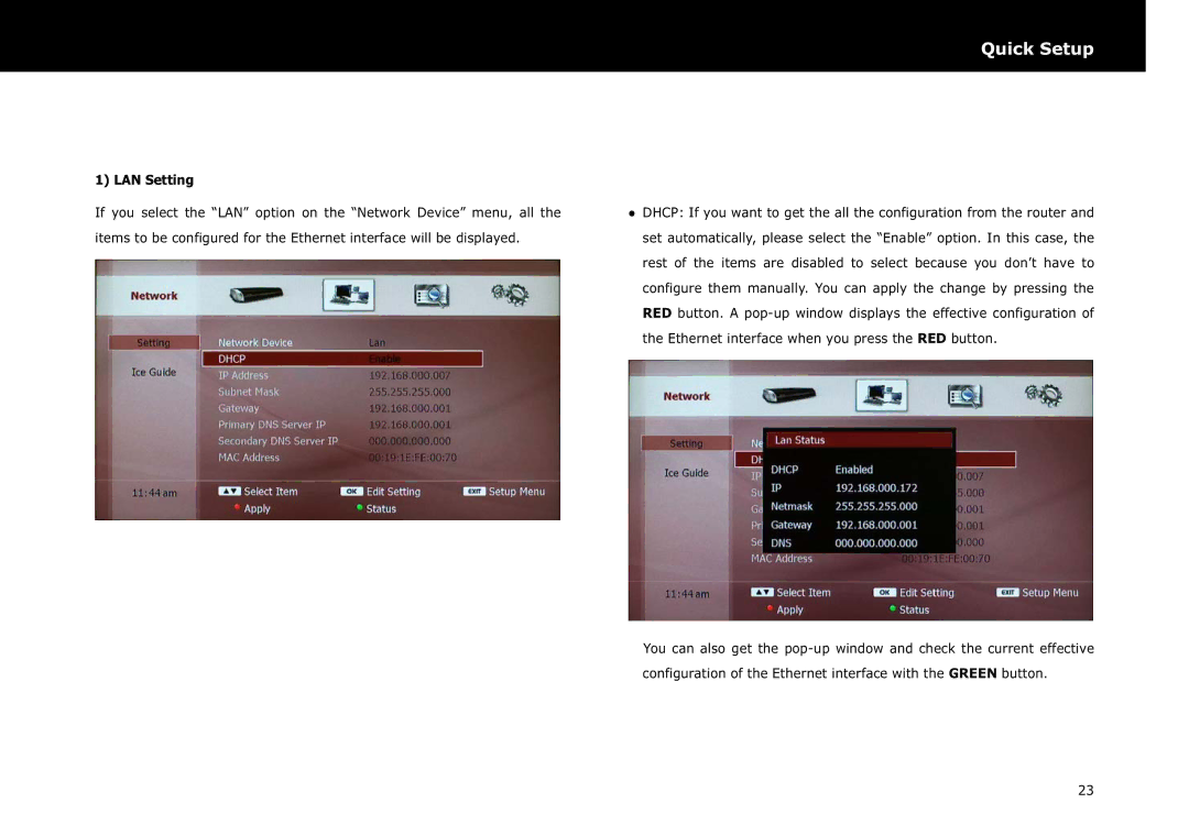 Beyonwiz DP-S1 manual LAN Setting 