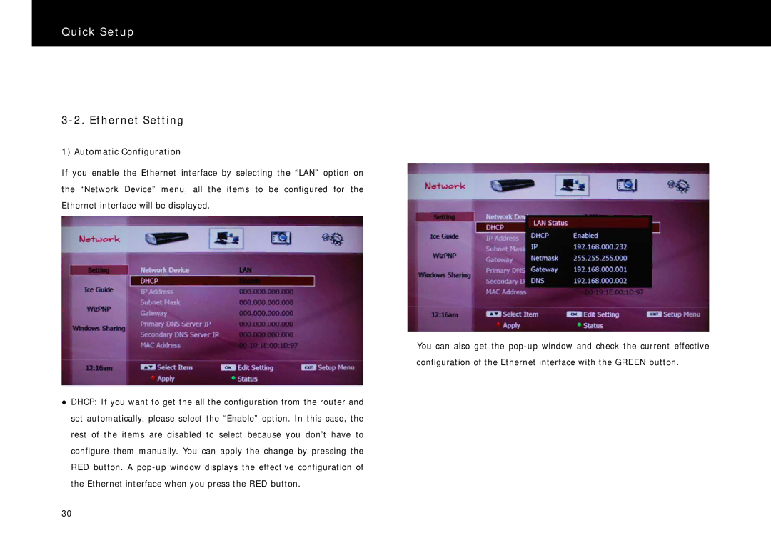 Beyonwiz DP-S1 manual Ethernet Setting, Automatic Configuration 