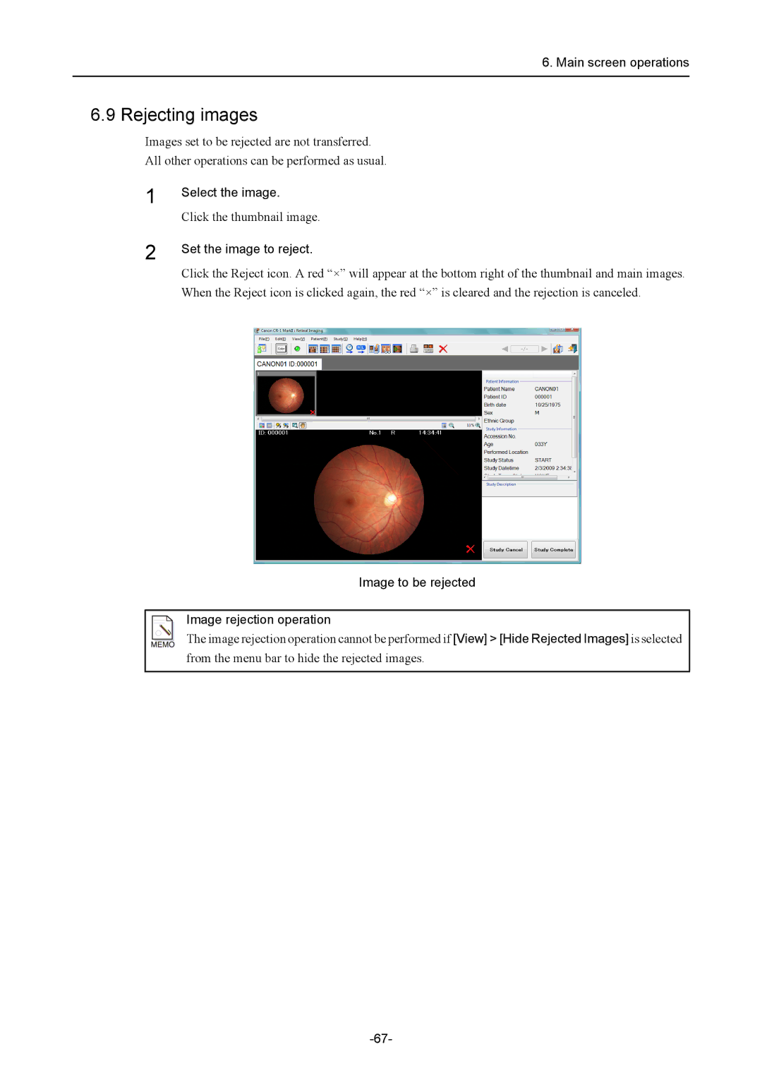 Canon CR-1 MARK II Rejecting images, Set the image to reject, Image to be rejected Image rejection operation 