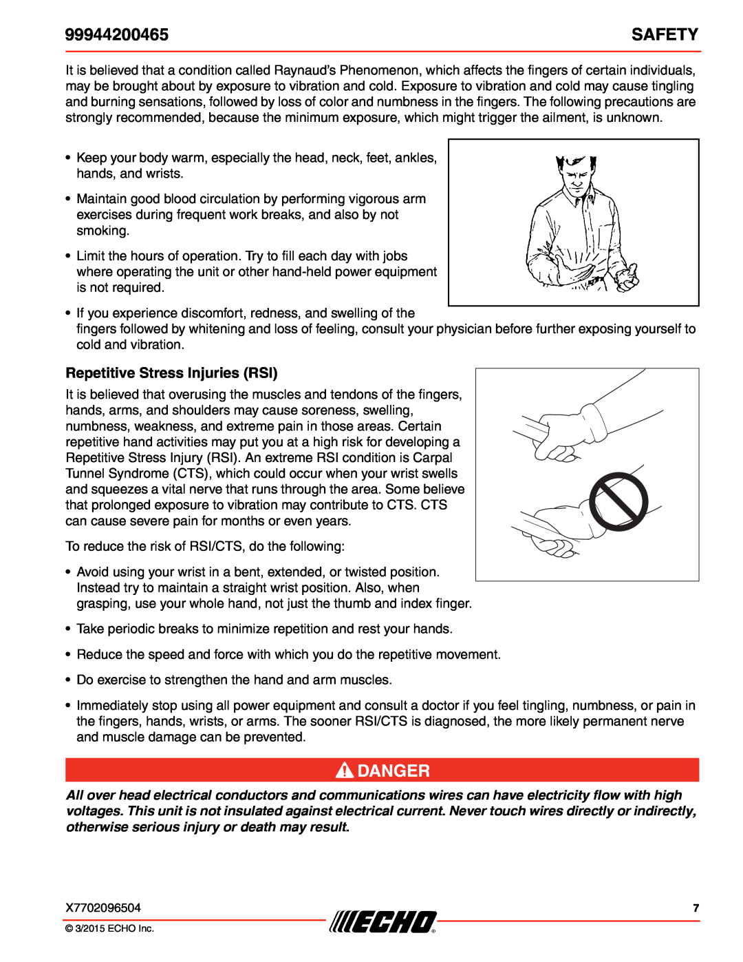 Echo 99944200465 specifications Safety, Repetitive Stress Injuries RSI 