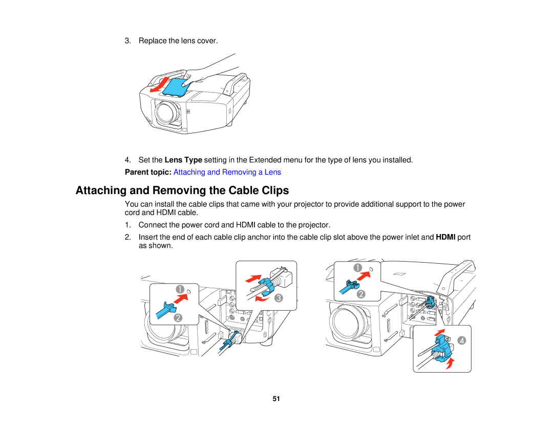 Epson Z10000UNL, Z9870UNL, Z11005NL, Z9900WNL, Z9870NL, Z9800WNL, Z9750UNL, Z10005UNL Attaching and Removing the Cable Clips 