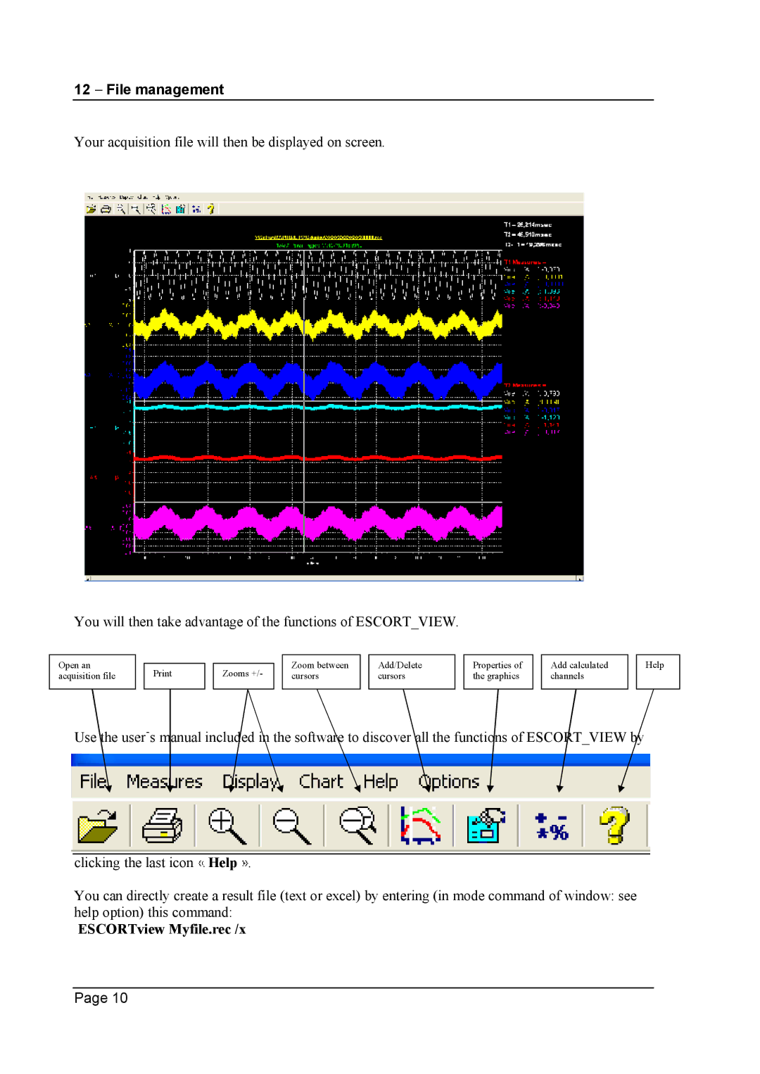 Escort 3004B, 3016B, 3008B user manual ESCORTview Myfile.rec /x 