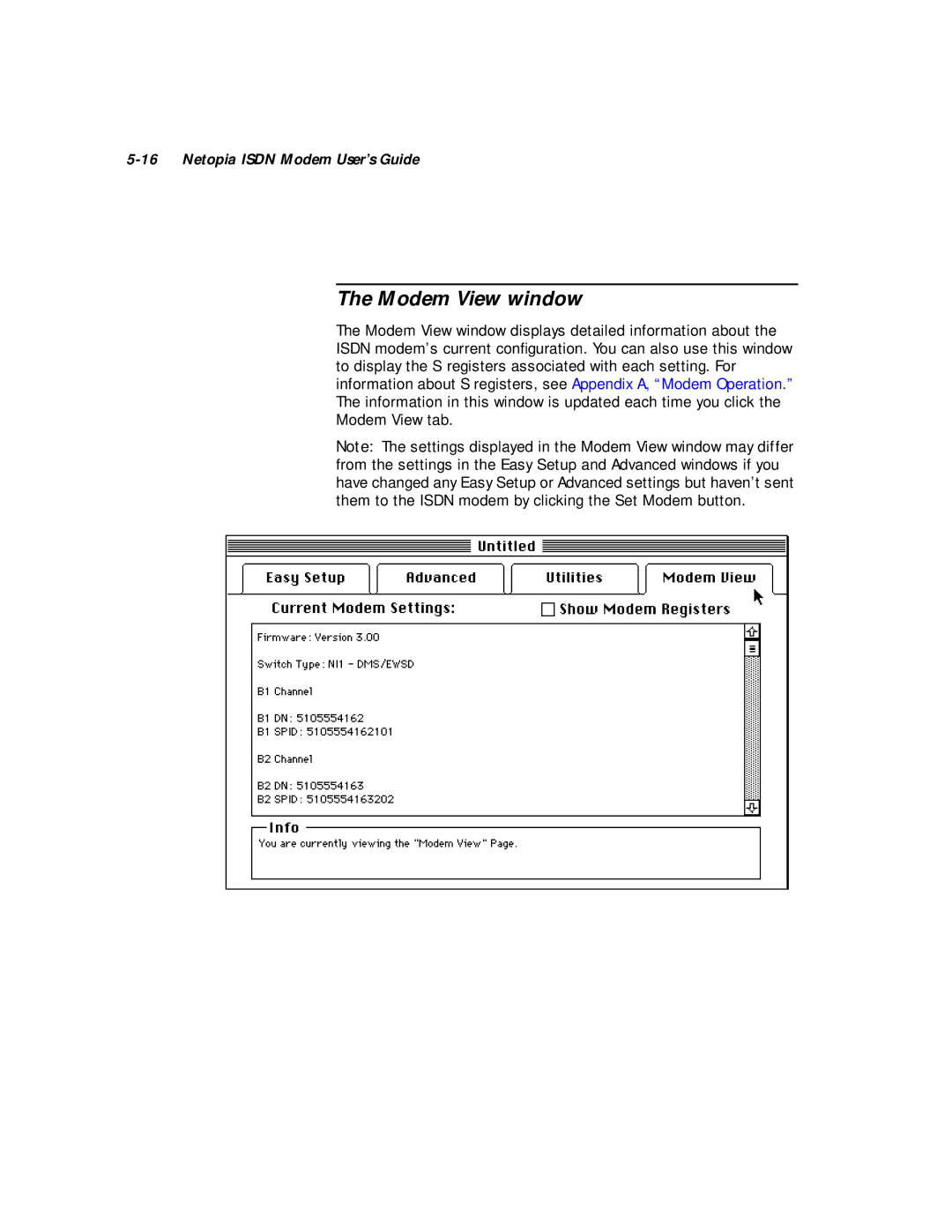 Farallon Communications 412, 612 manual Modem View window 