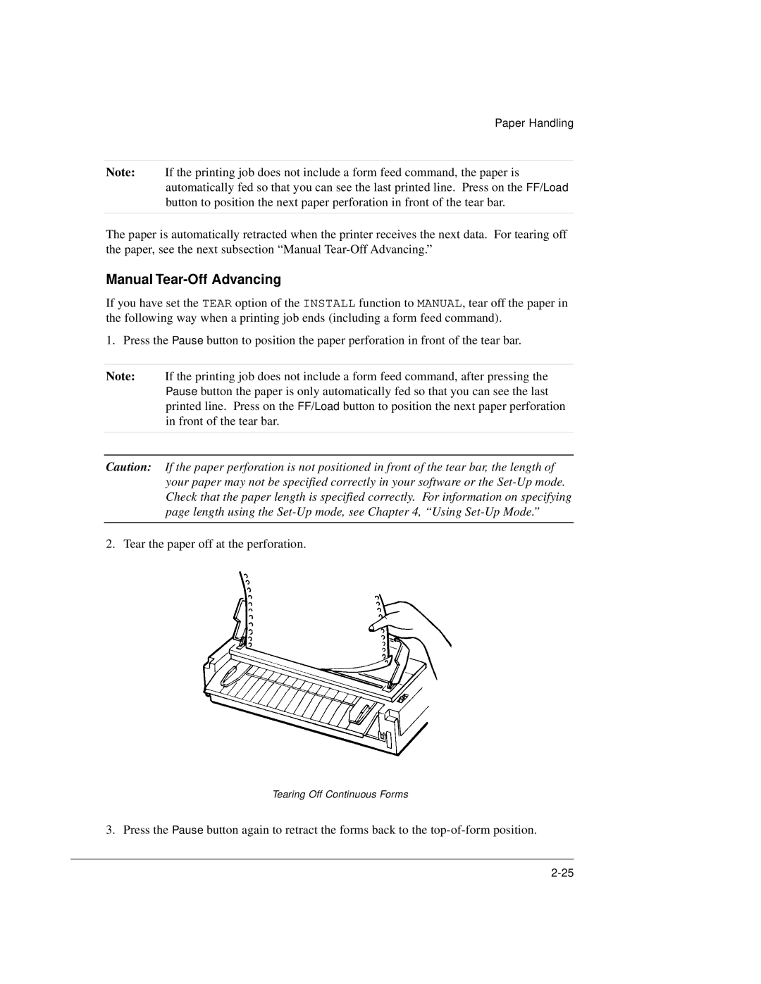 Genicom LA36 manual Manual Tear-Off Advancing 