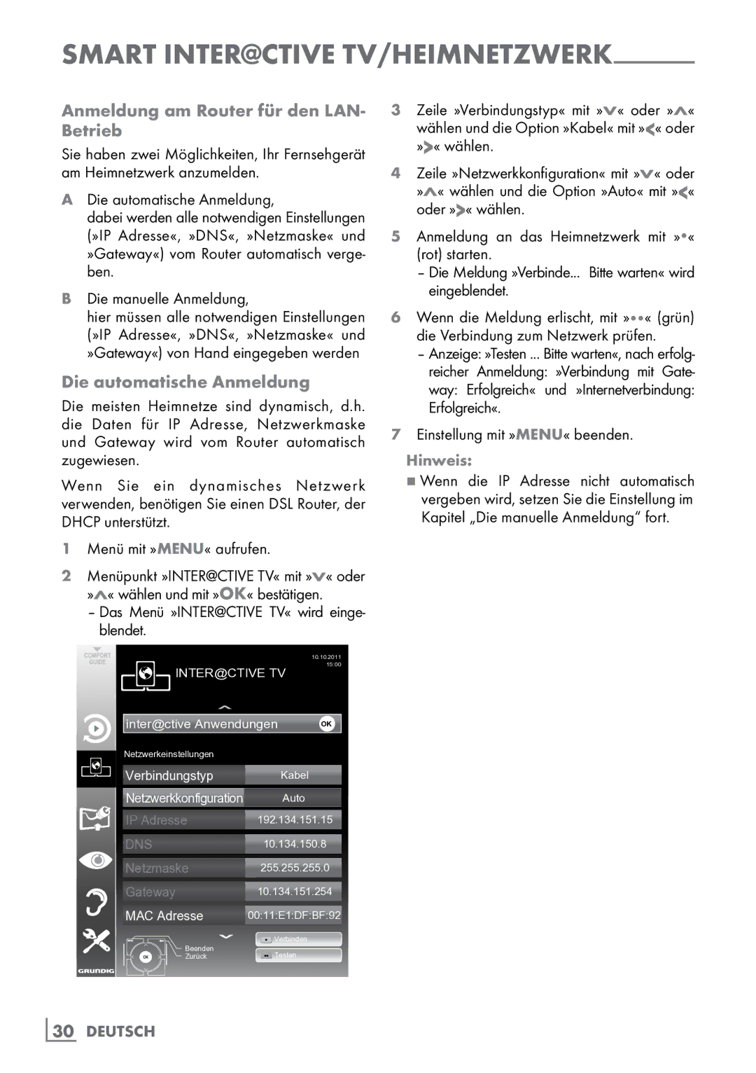 Grundig 40 VLE 8160 BH manual Anmeldung am Router für den LAN- Betrieb, Die automatische Anmeldung 