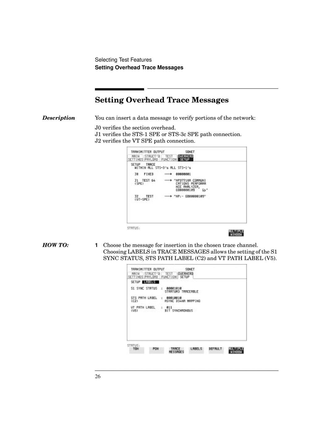 HP BER 718 37718A manual Setting Overhead Trace Messages 