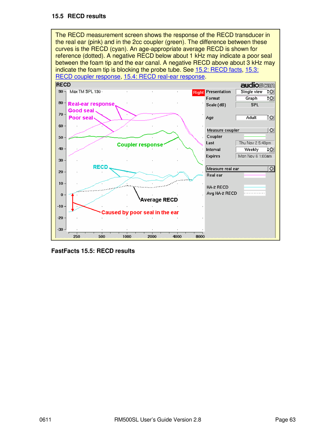 HP RM500SL manual FastFacts 15.5 Recd results 