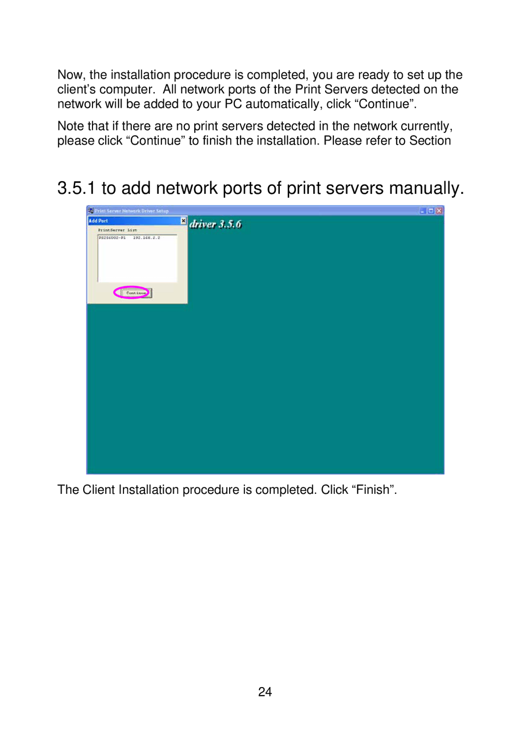 MicroNet Technology SP755D, SP756 user manual To add network ports of print servers manually 