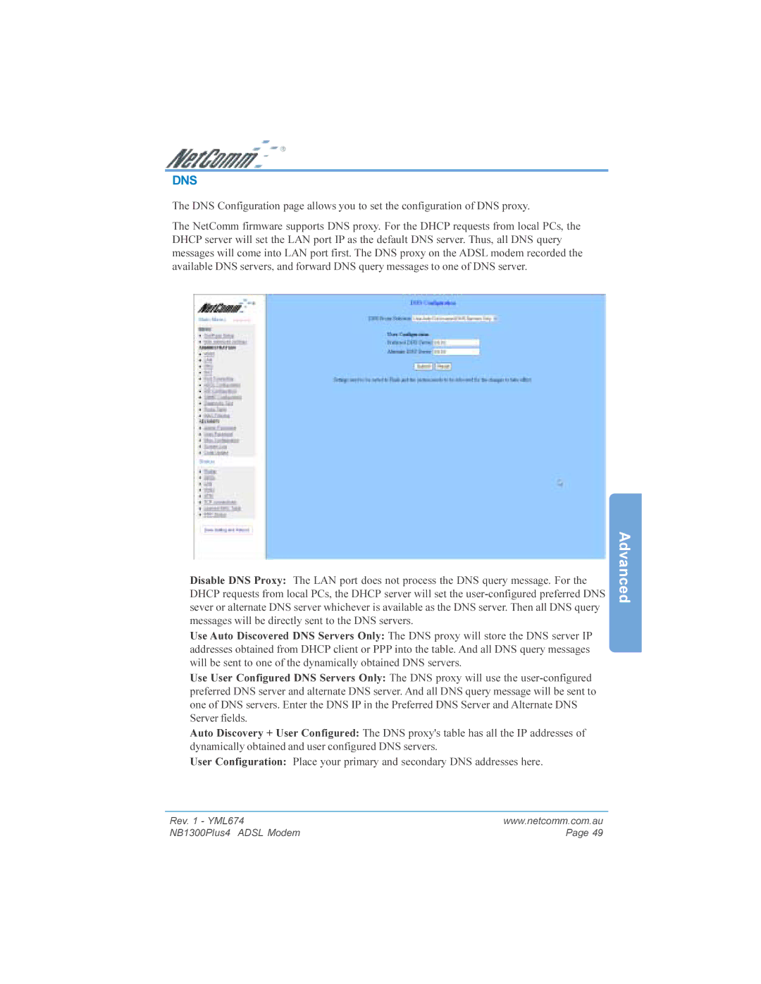 NetComm NB1300PLUS4 manual Dns 