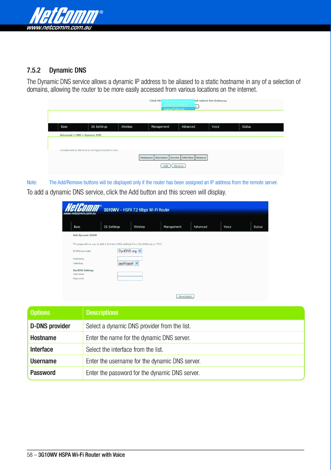 NordicTrack 3G10WV manual Dynamic DNS, Options Descriptions 