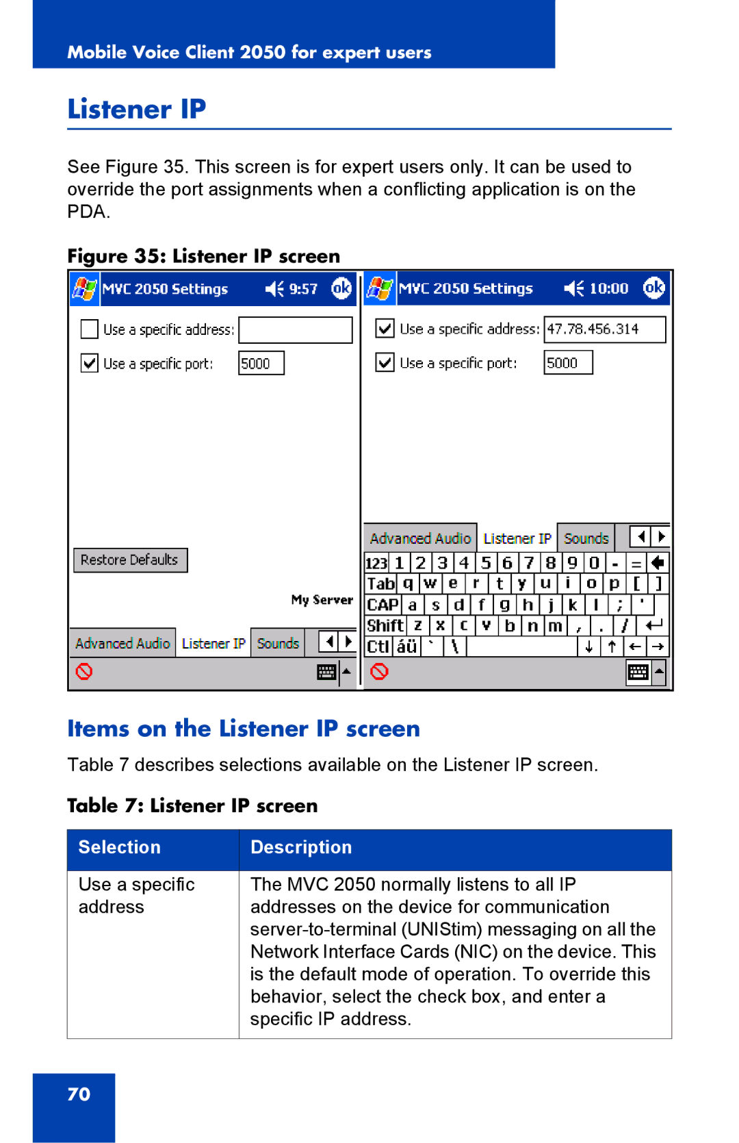 Nortel Networks 2050 manual Items on the Listener IP screen 