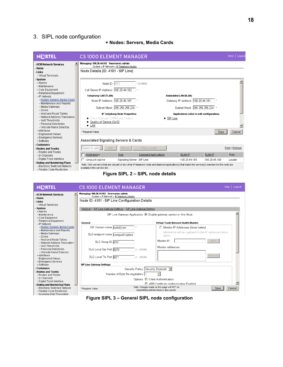 Nortel Networks 2330 quick start Sipl node configuration 