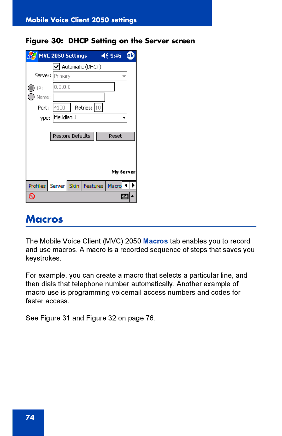 Nortel Networks N0035509 manual Macros, Dhcp Setting on the Server screen 