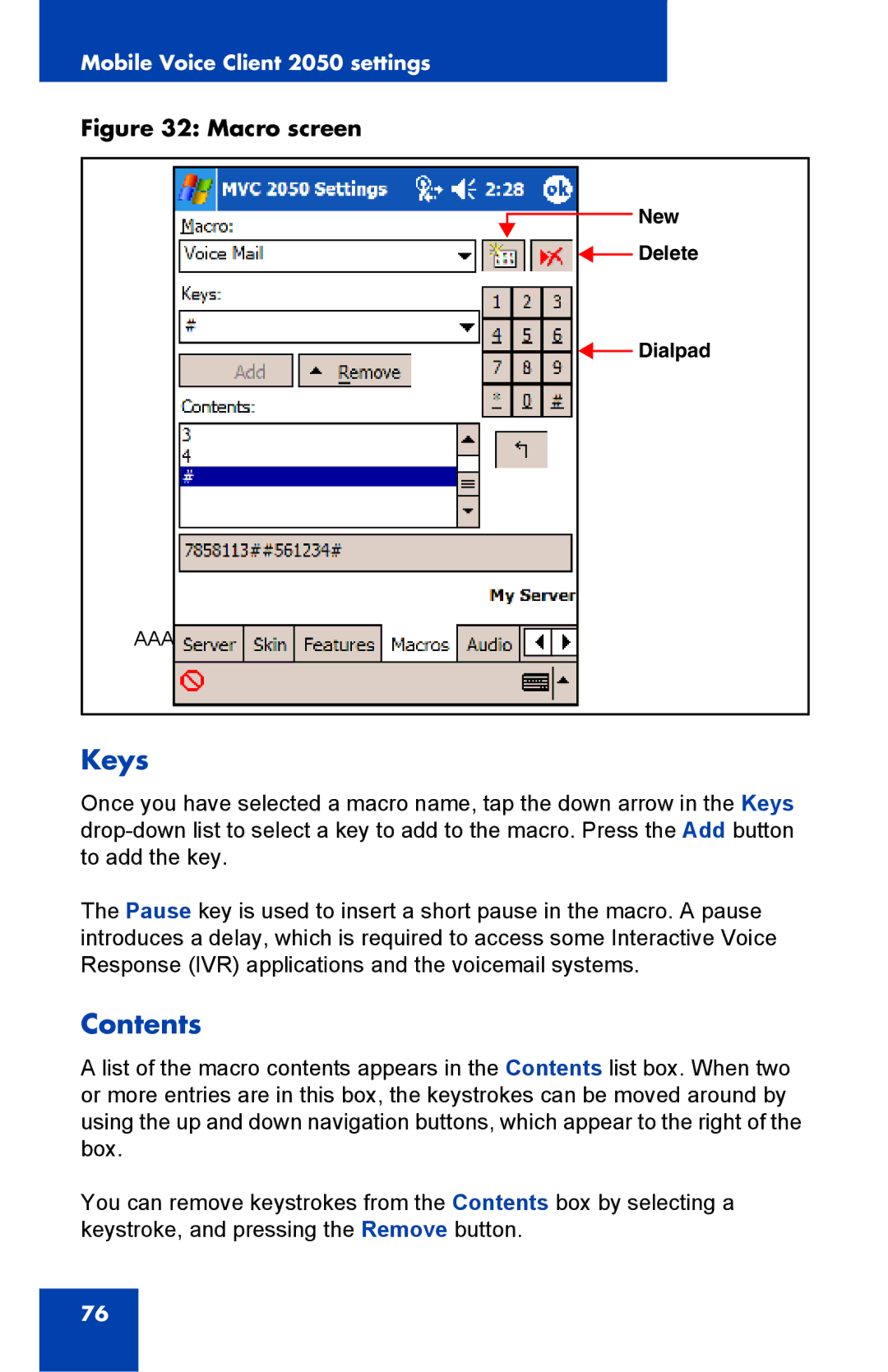 Nortel Networks N0035509 manual Keys, Contents 