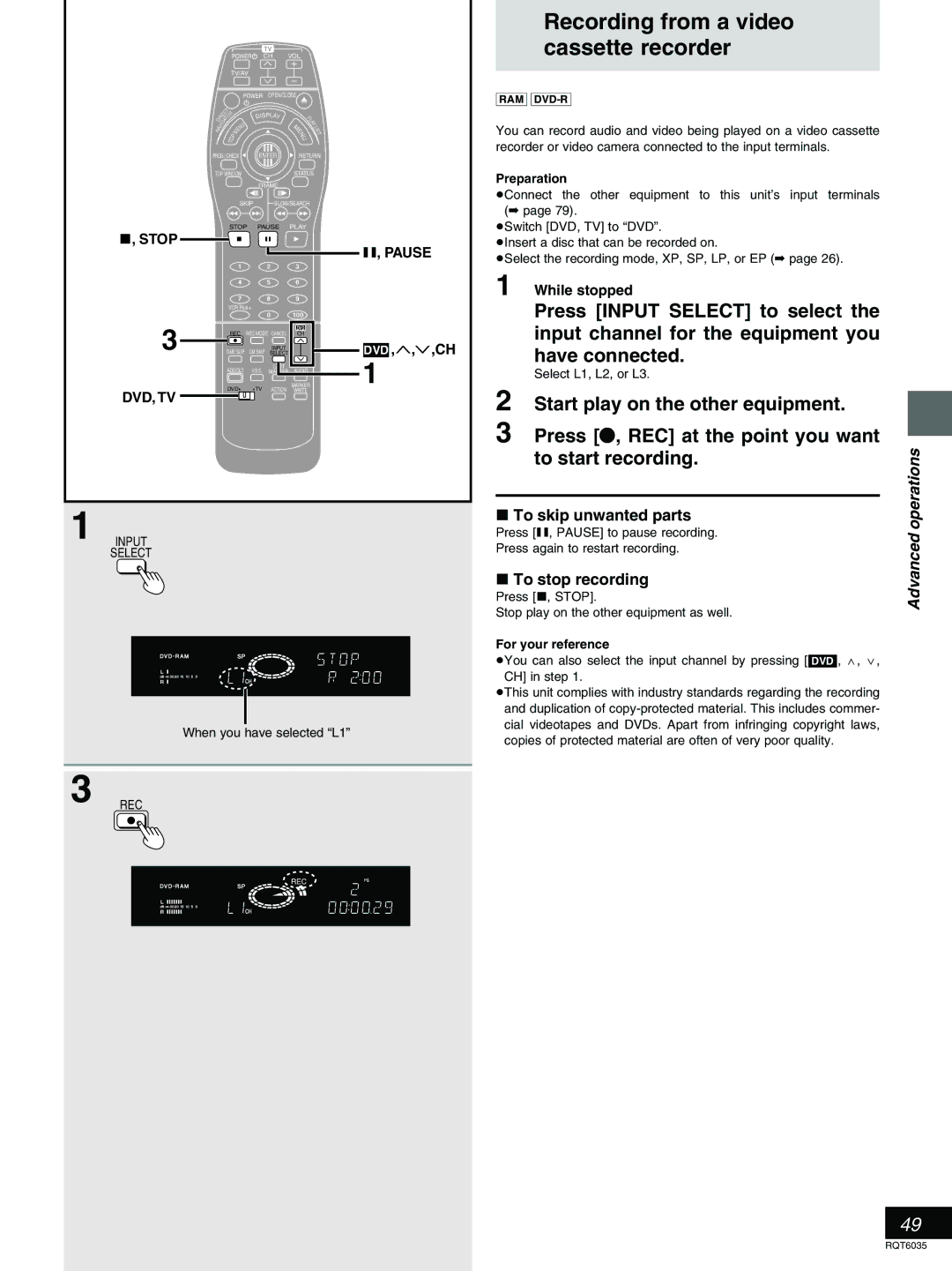 Panasonic DMR-E20 warranty To skip unwanted parts, Input, Select 