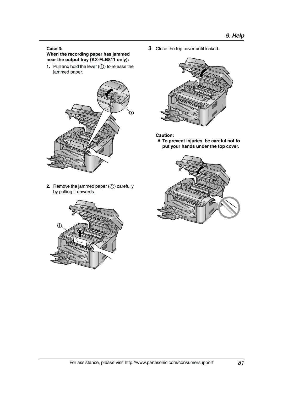 Panasonic KX-FLB811 manual Pull and hold the lever 1 to release the jammed paper 