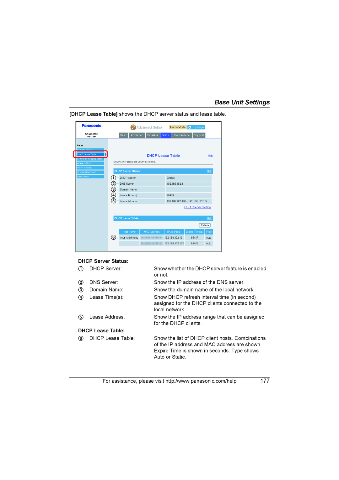 Panasonic KX WP1050 operating instructions Dhcp Server Status, Dhcp Lease Table 