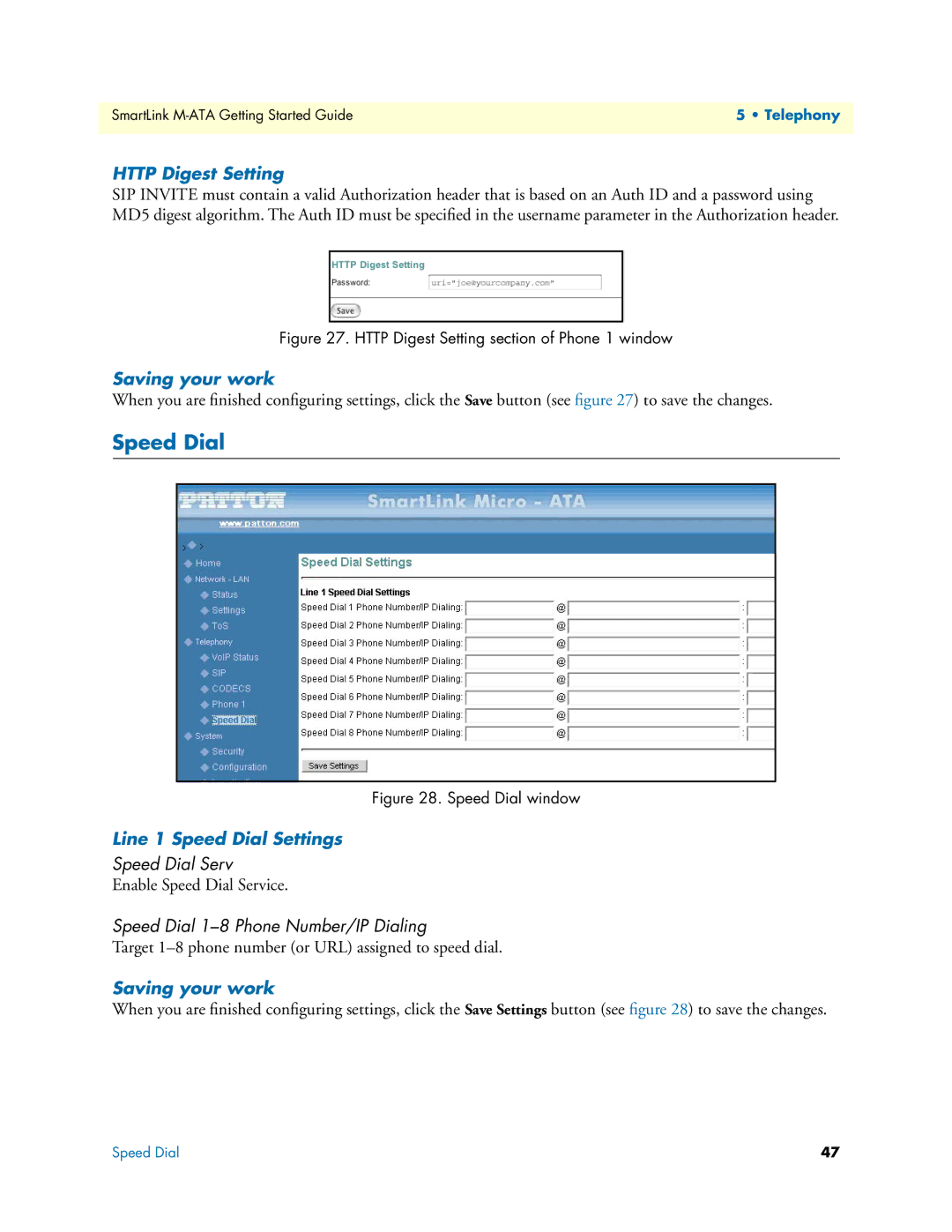 Patton electronic M-ATA manual Http Digest Setting, Line 1 Speed Dial Settings, Speed Dial Serv 