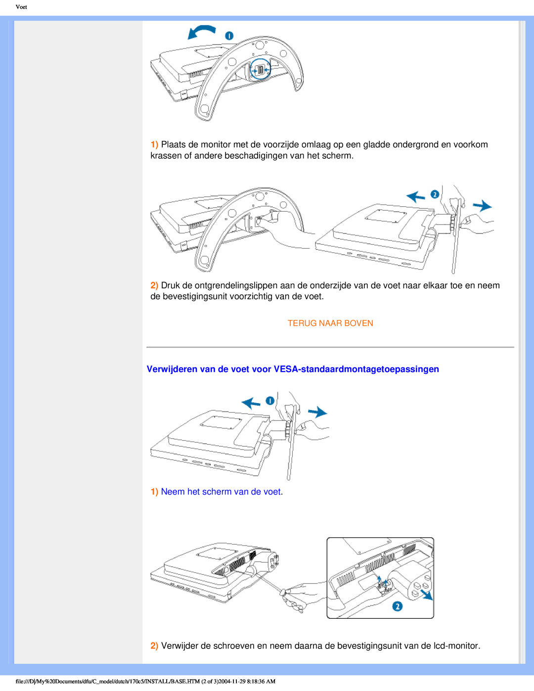 Philips 170C5 user manual Verwijderen van de voet voor VESA-standaardmontagetoepassingen, Neem het scherm van de voet 