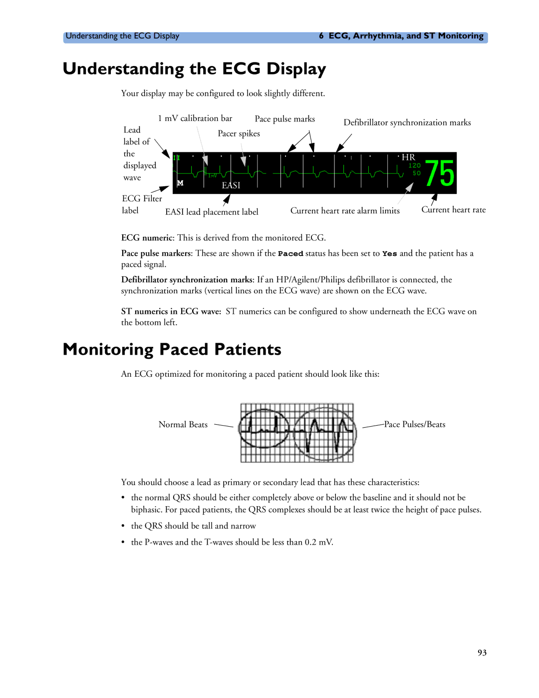 Philips MP40/50, MP60/70/80/90, MP20/30 manual Understanding the ECG Display, Monitoring Paced Patients 