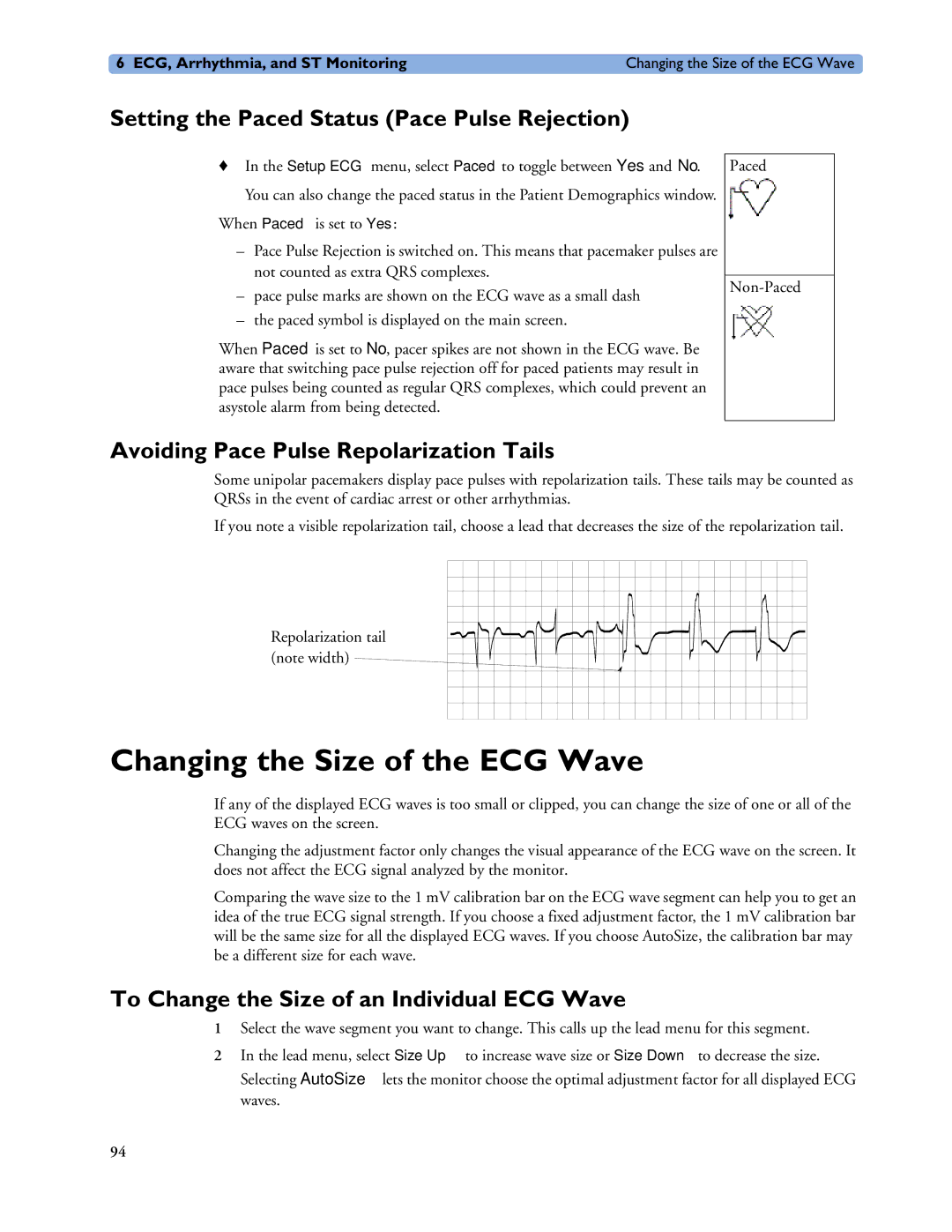 Philips MP60/70/80/90, MP20/30, MP40/50 Changing the Size of the ECG Wave, Setting the Paced Status Pace Pulse Rejection 