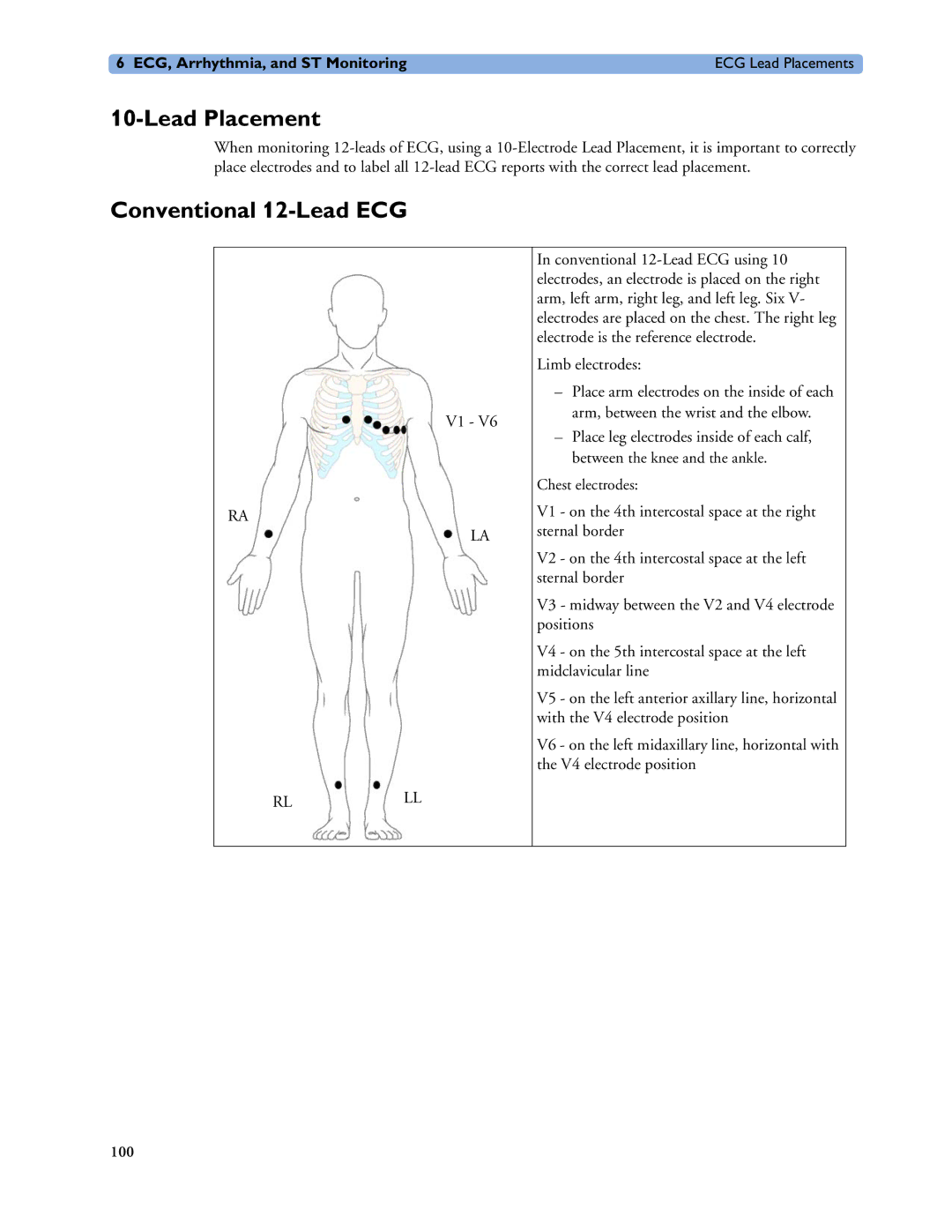 Philips MP60/70/80/90, MP20/30, MP40/50 manual Lead Placement, Conventional 12-Lead ECG 