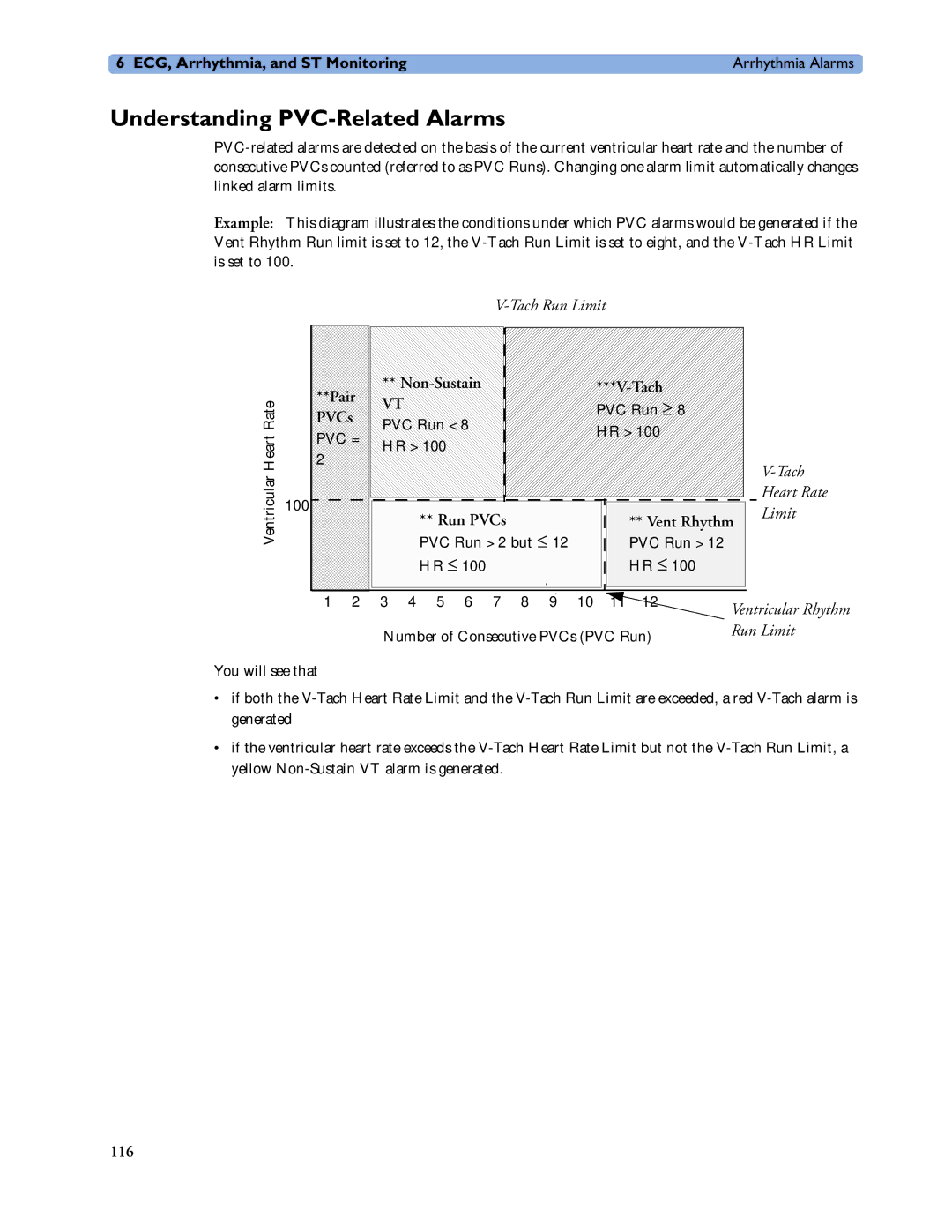 Philips MP20/30, MP60/70/80/90, MP40/50 manual Understanding PVC-Related Alarms, Non-Sustain Tach, Run PVCs, Pair PVCs 
