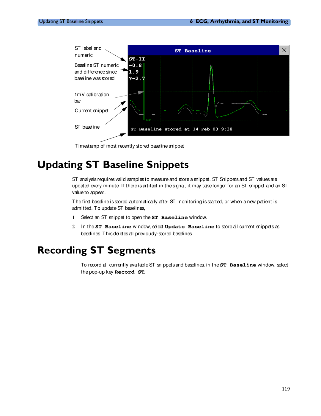 Philips MP20/30, MP60/70/80/90, MP40/50 manual Updating ST Baseline Snippets, Recording ST Segments 