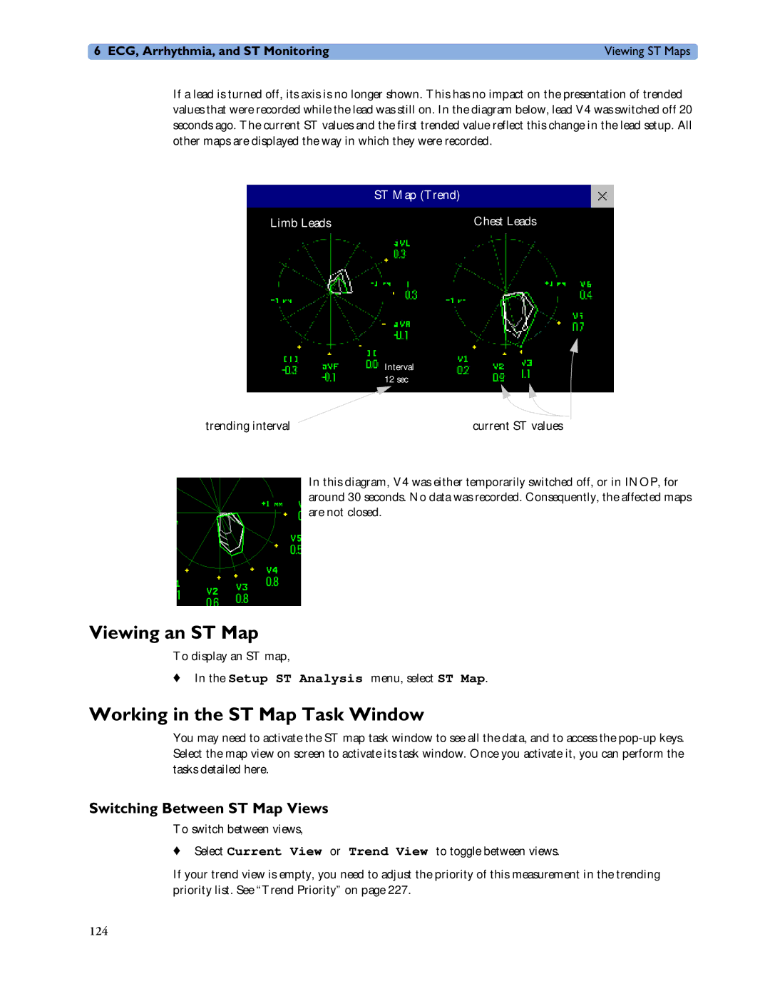 Philips MP60/70/80/90, MP20/30 manual Viewing an ST Map, Working in the ST Map Task Window, Switching Between ST Map Views 