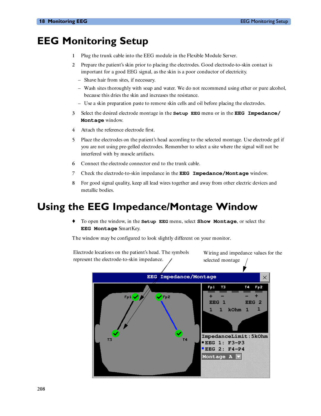 Philips MP60/70/80/90, MP20/30, MP40/50 EEG Monitoring Setup, Using the EEG Impedance/Montage Window, EEG Montage SmartKey 