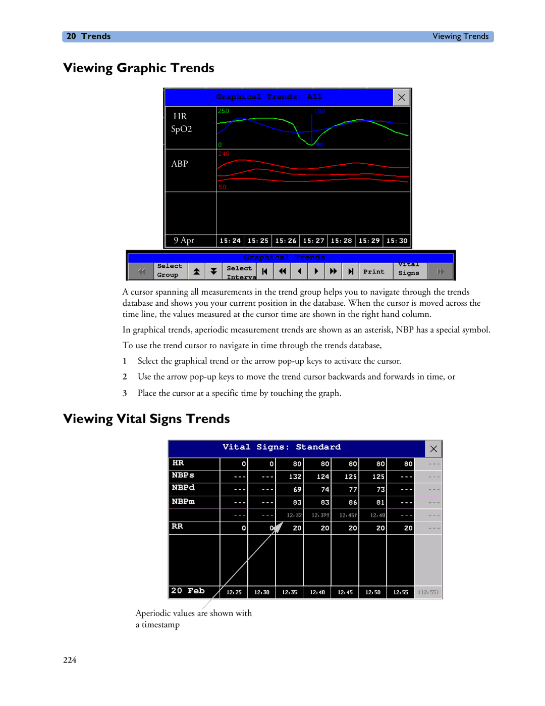 Philips MP20/30, MP60/70/80/90, MP40/50 manual Viewing Graphic Trends, Viewing Vital Signs Trends 