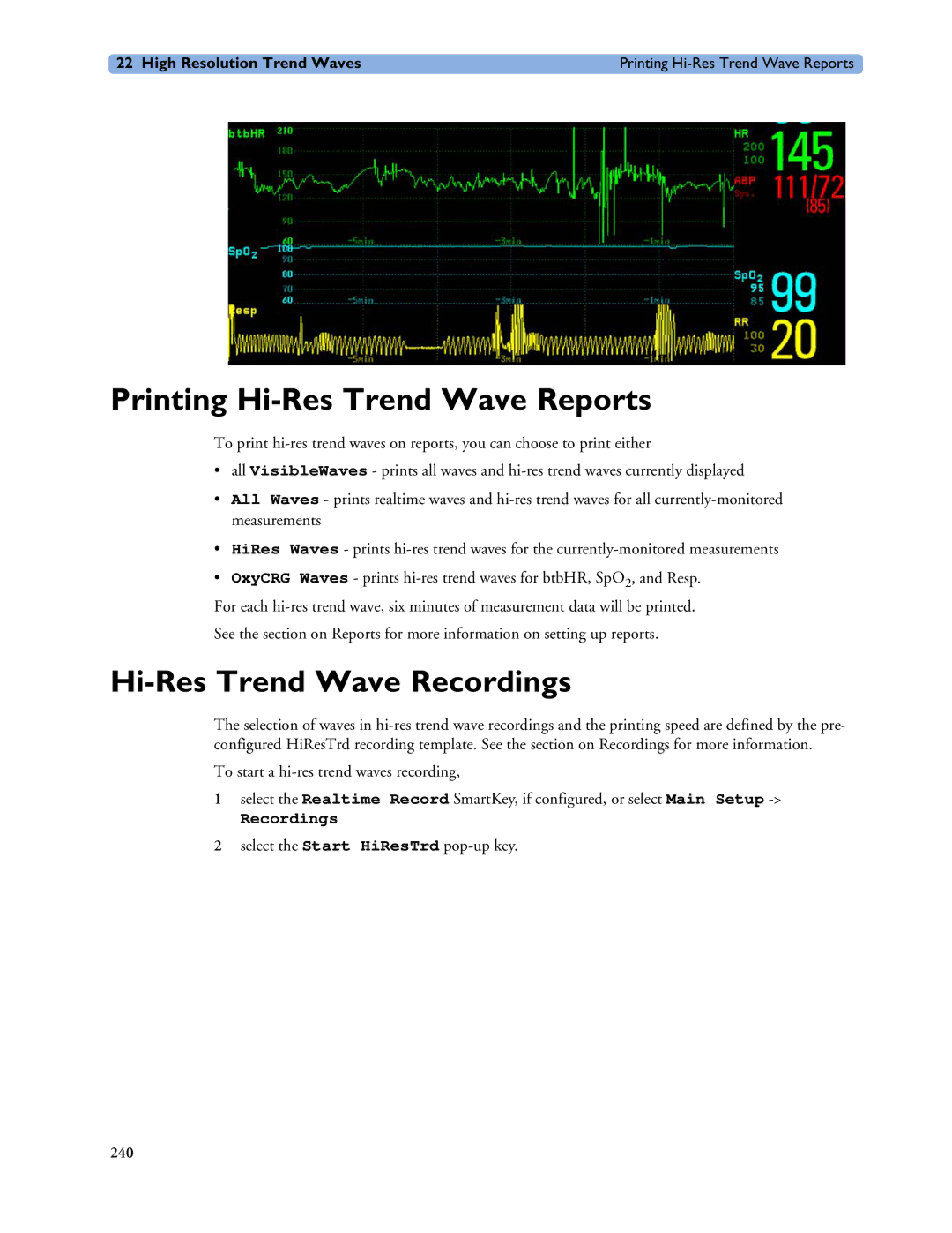 Philips MP40/50, MP60/70/80/90, MP20/30 manual Printing Hi-Res Trend Wave Reports, Hi-Res Trend Wave Recordings 