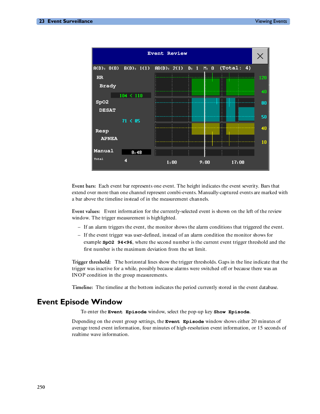 Philips MP60/70/80/90, MP20/30, MP40/50 manual Event Episode Window, Apnea 