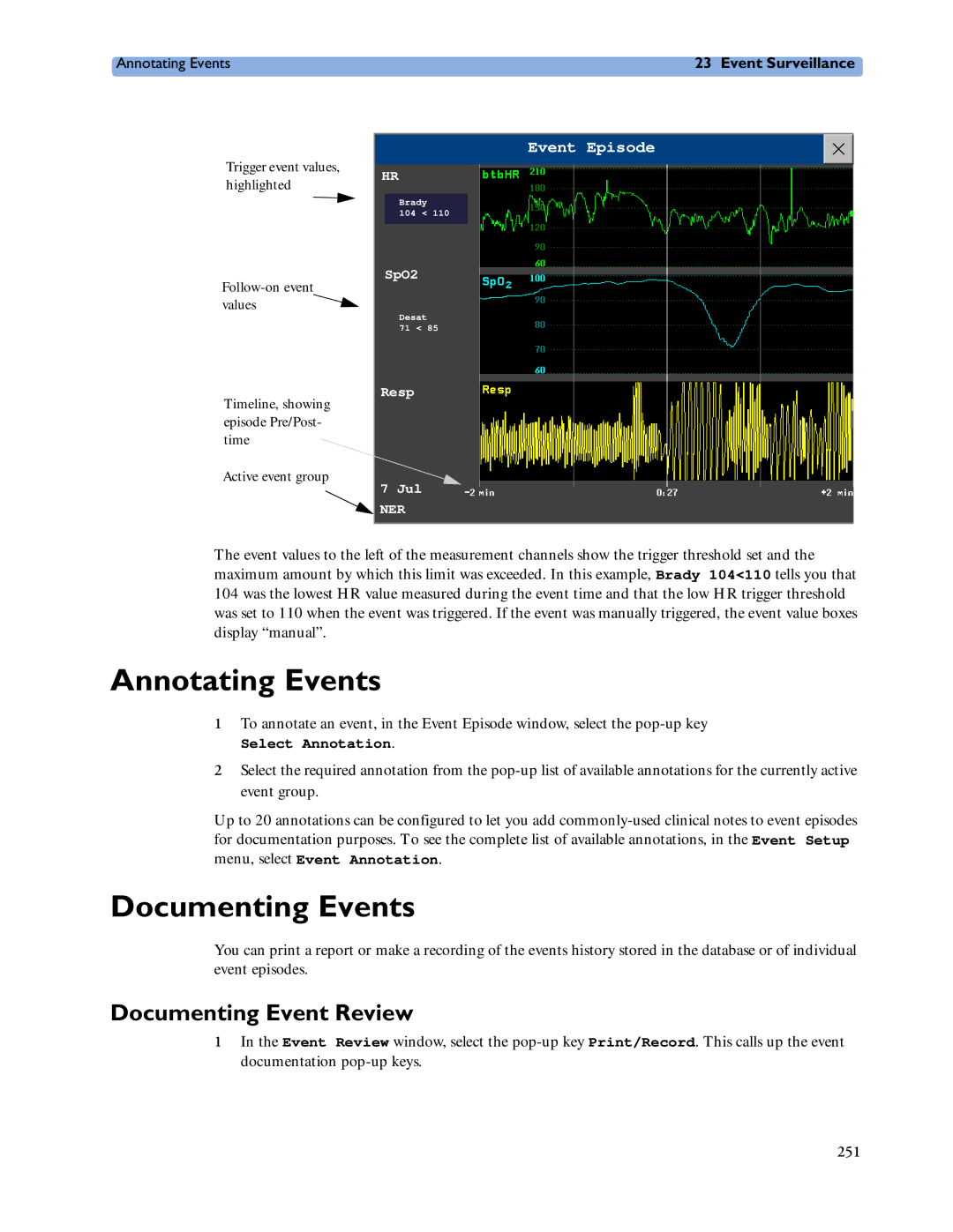 Philips MP20/30, MP60/70/80/90, MP40/50 manual Annotating Events, Documenting Events, Documenting Event Review 