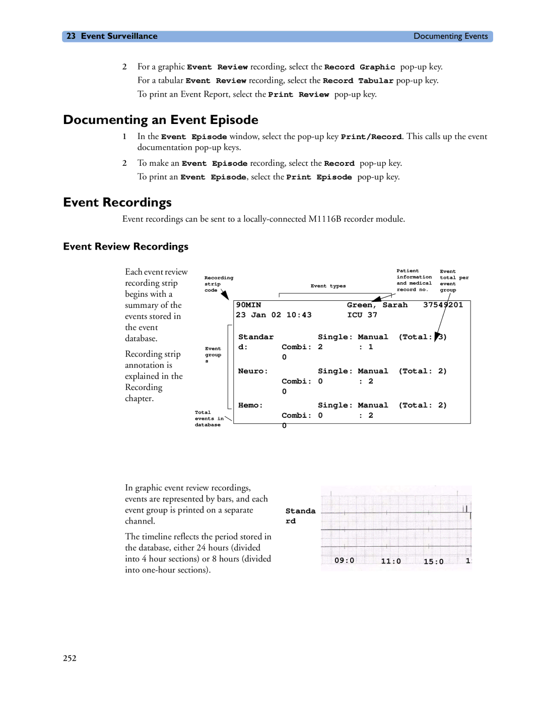 Philips MP40/50, MP60/70/80/90, MP20/30 manual Documenting an Event Episode, Event Recordings, Event Review Recordings 