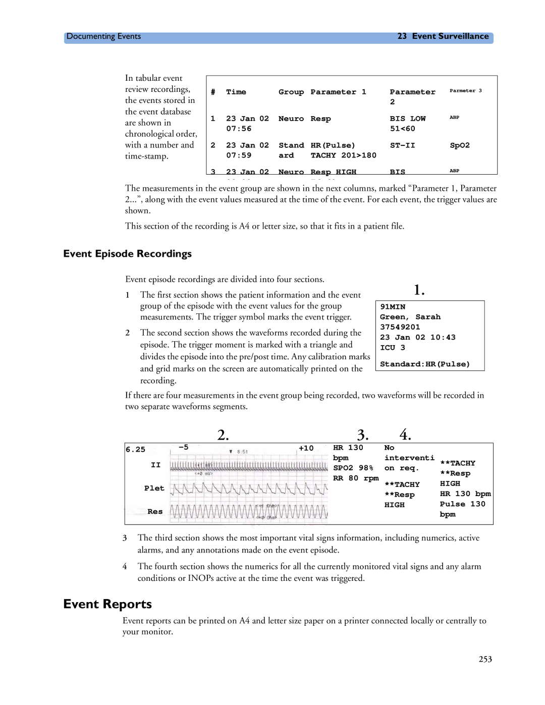 Philips MP60/70/80/90, MP20/30, MP40/50 manual Event Reports, Event Episode Recordings, Plet, Res 