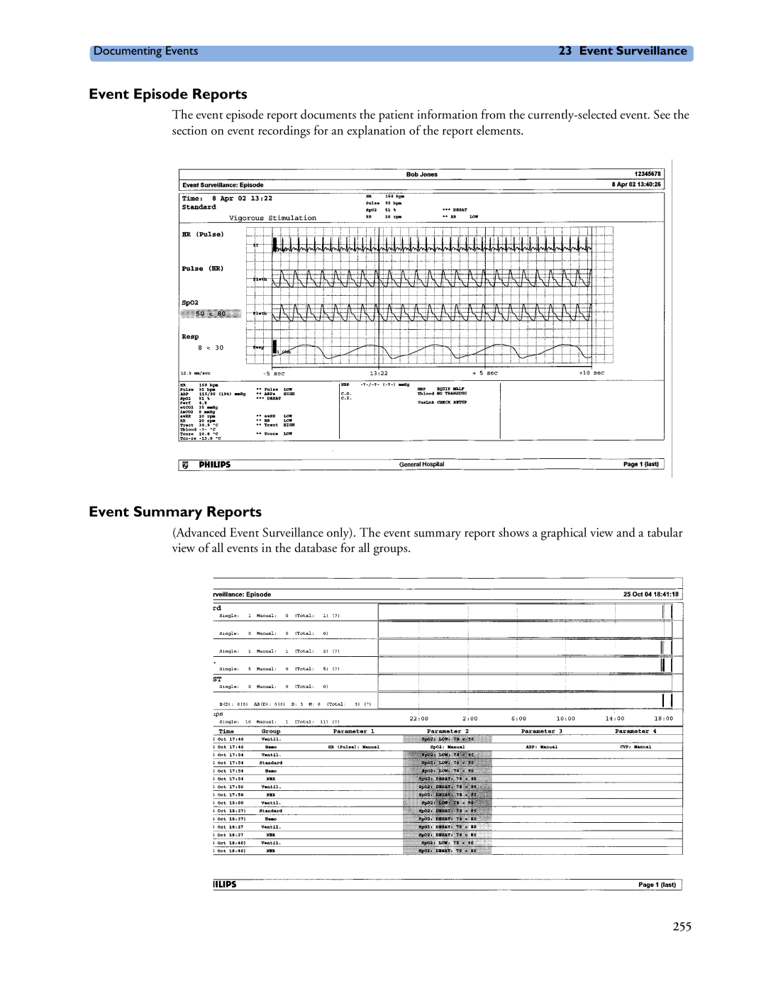 Philips MP40/50, MP60/70/80/90, MP20/30 manual Event Episode Reports, Event Summary Reports 