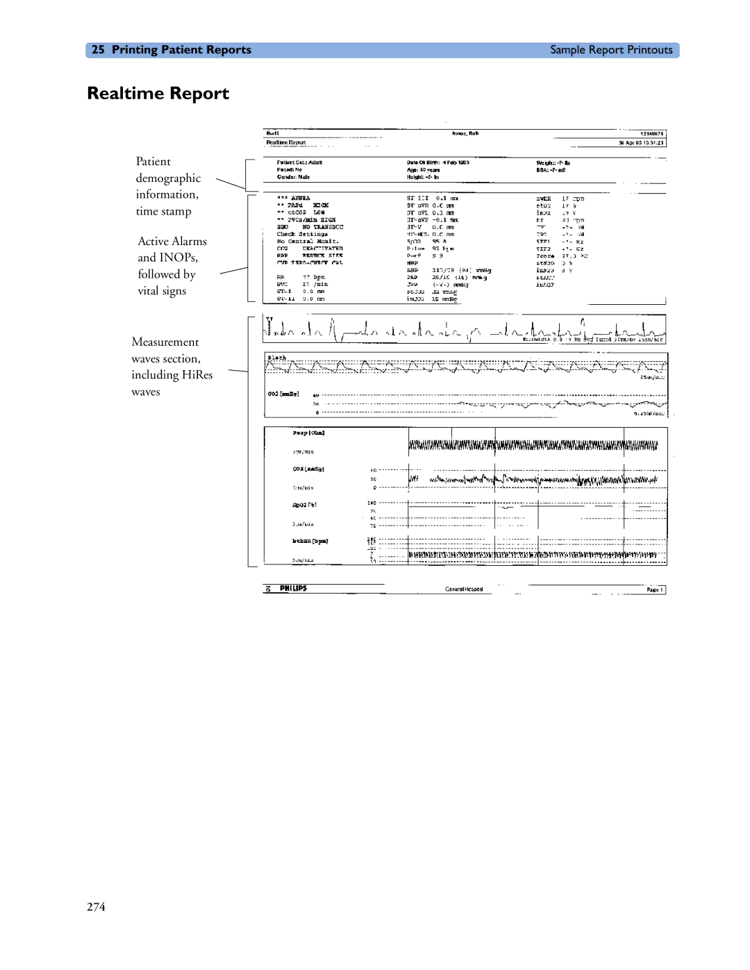 Philips MP60/70/80/90, MP20/30, MP40/50 manual Realtime Report 