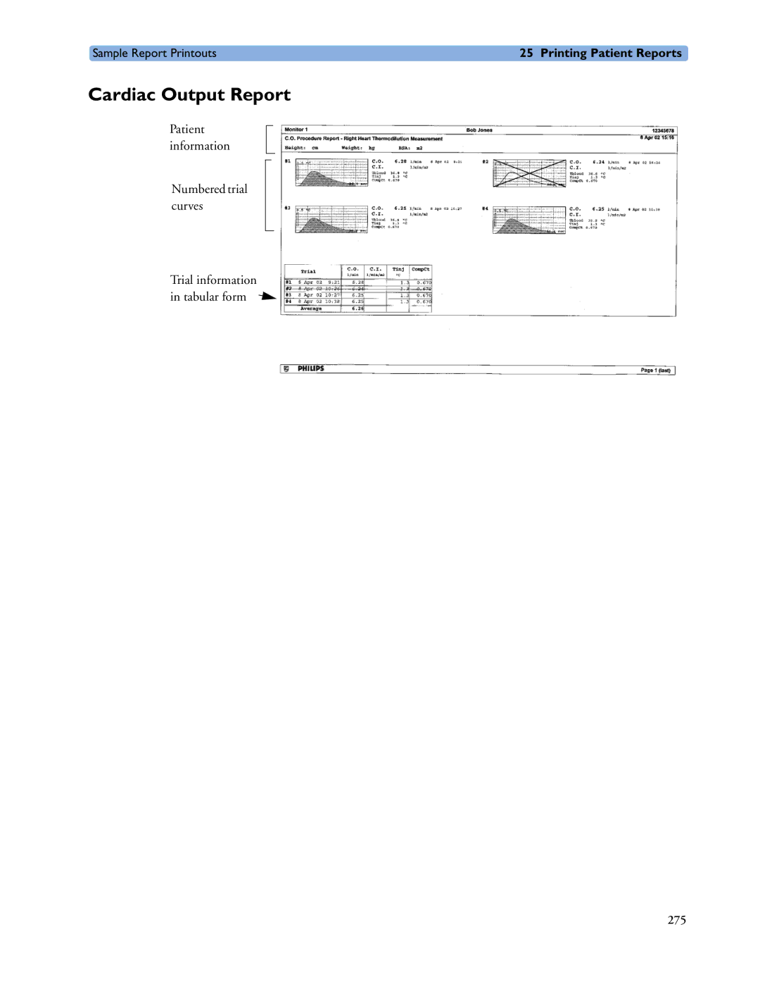 Philips MP20/30, MP60/70/80/90, MP40/50 manual Cardiac Output Report 