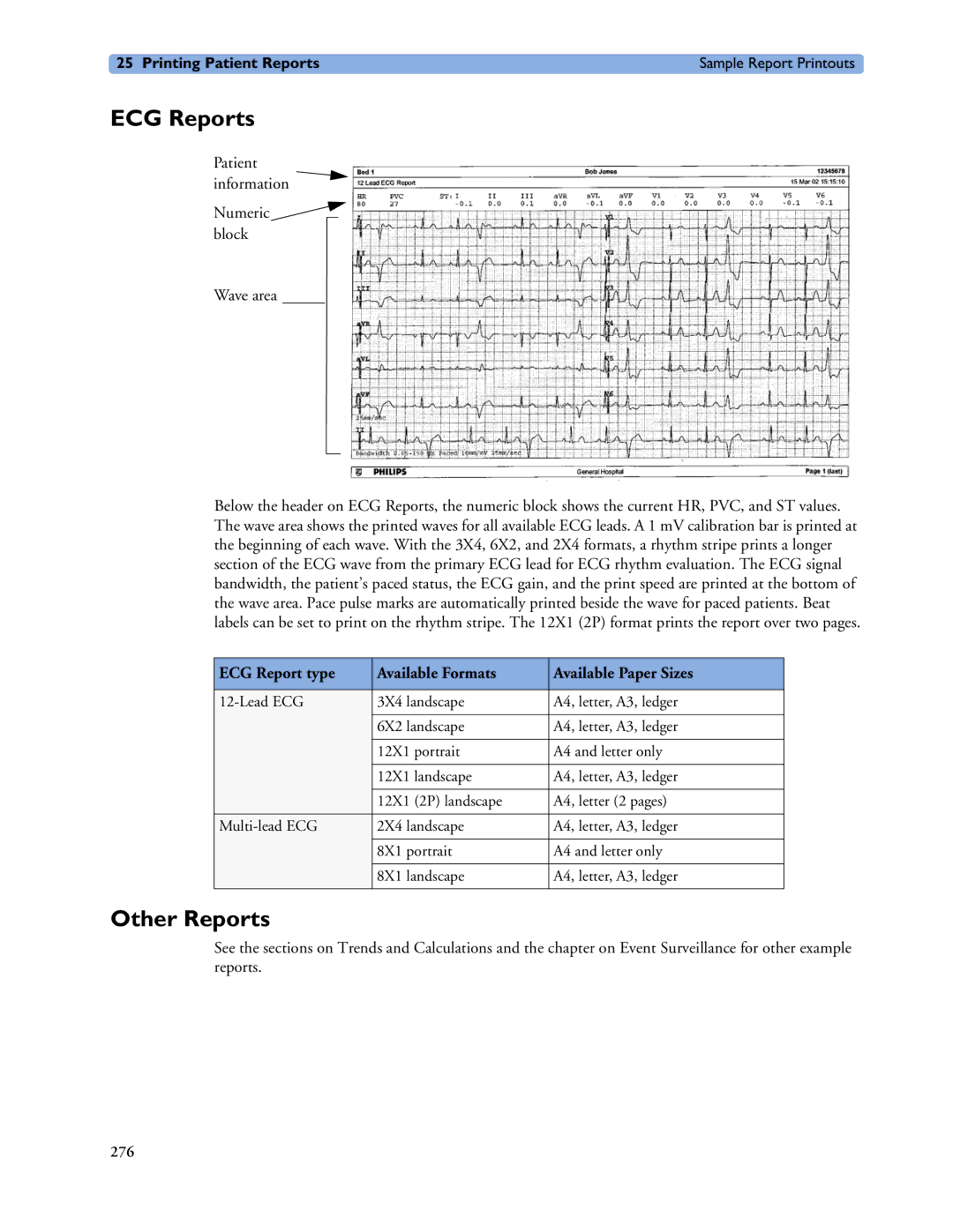 Philips MP40/50, MP60/70/80/90, MP20/30 ECG Reports, Other Reports, ECG Report type Available Formats Available Paper Sizes 