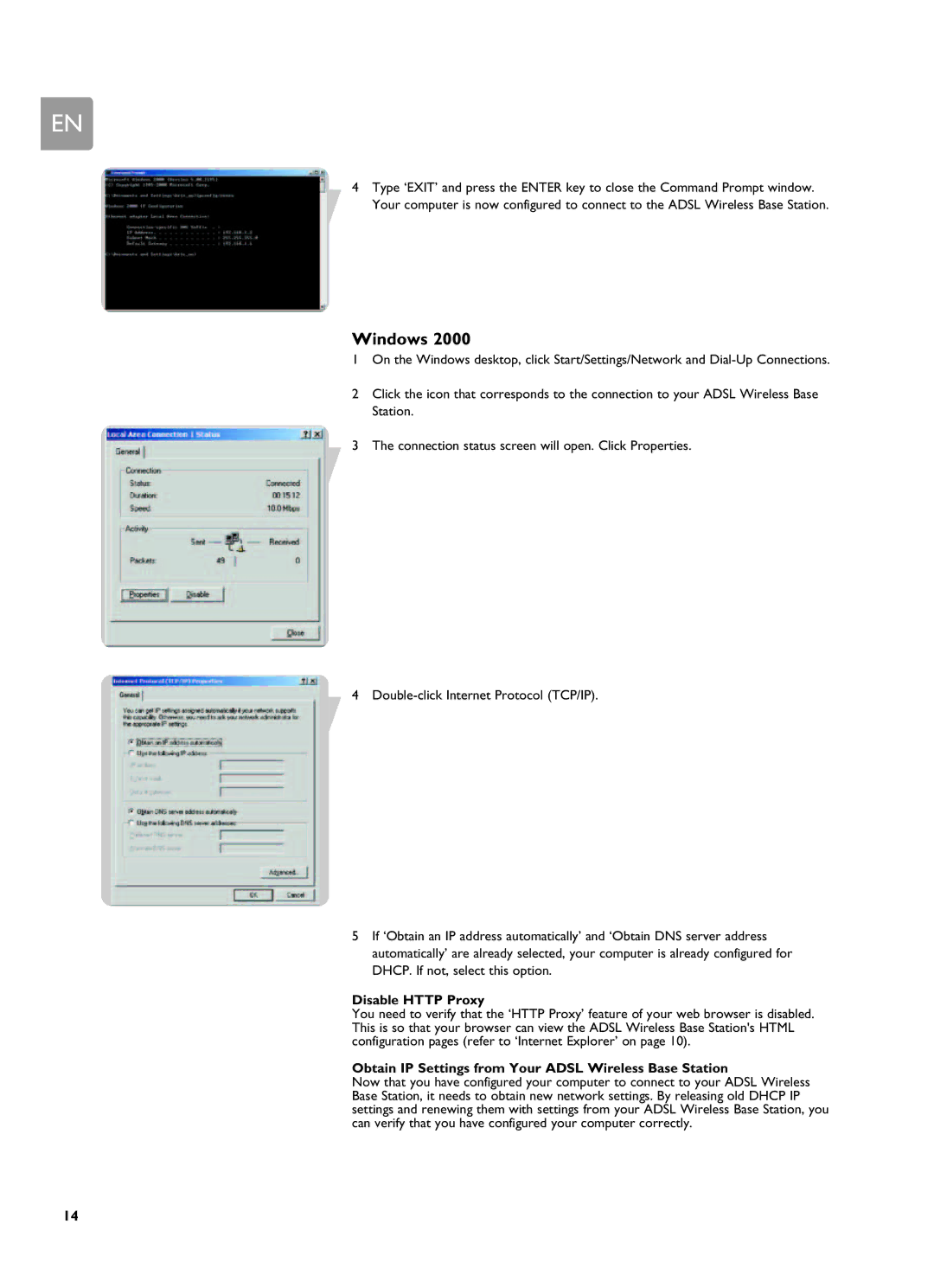 Philips SNA6500 user manual Windows, Obtain IP Settings from Your Adsl Wireless Base Station 