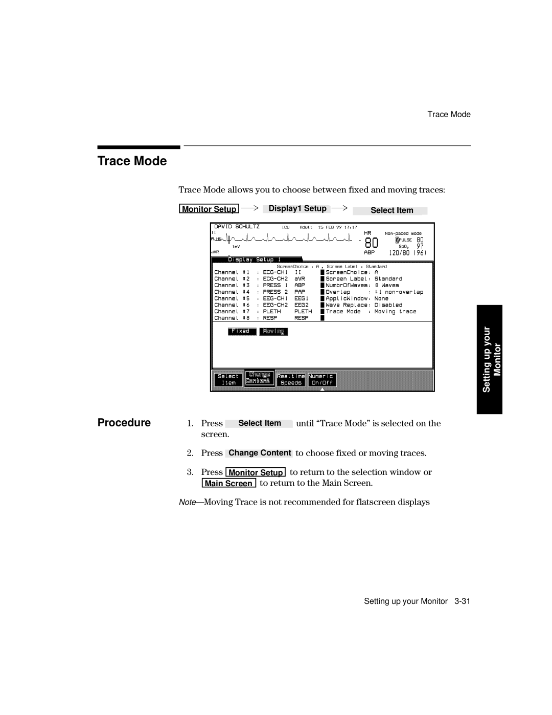 Philips V24CT, V26CT manual Trace Mode, Press To choose fixed or moving traces 