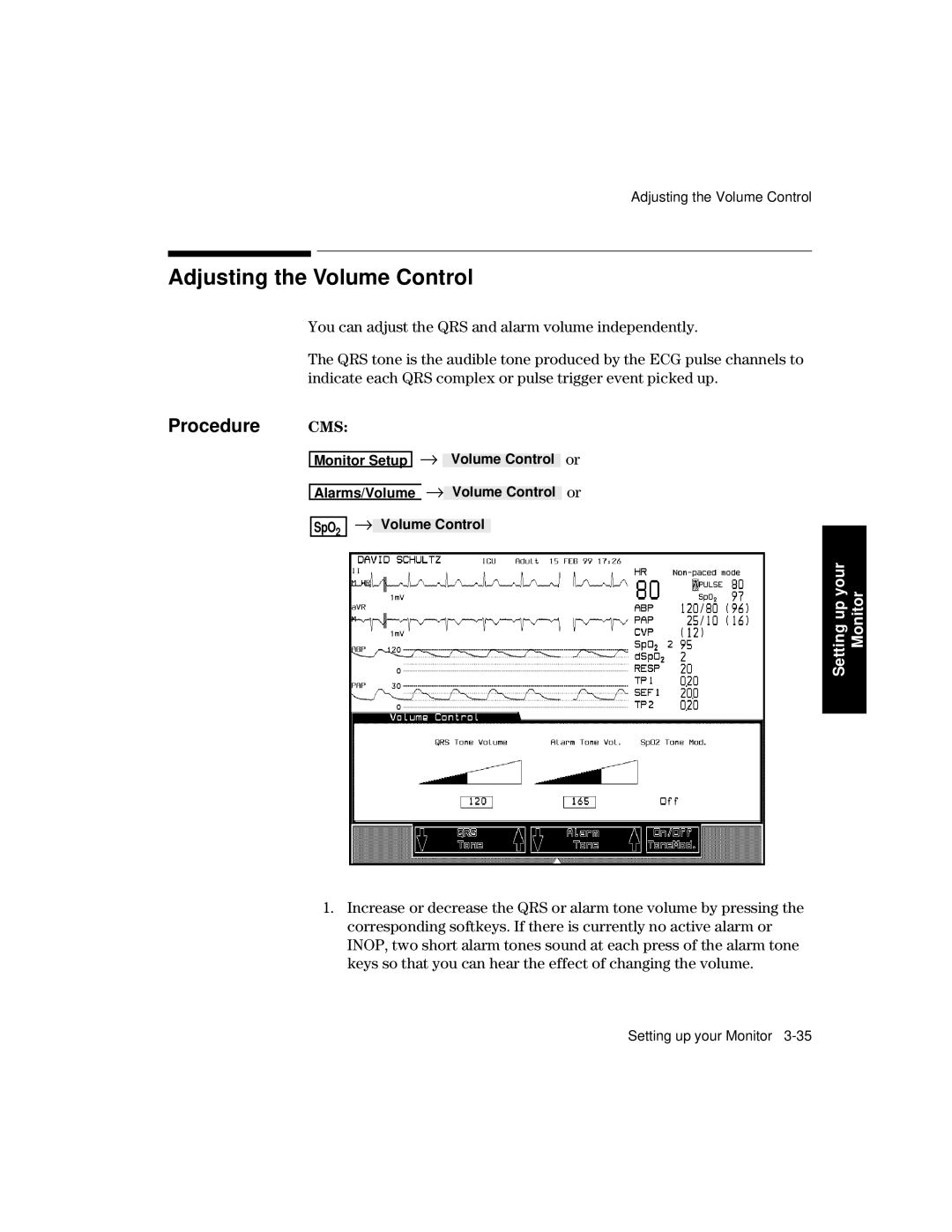 Philips V24CT, V26CT manual Adjusting the Volume Control, Procedure 