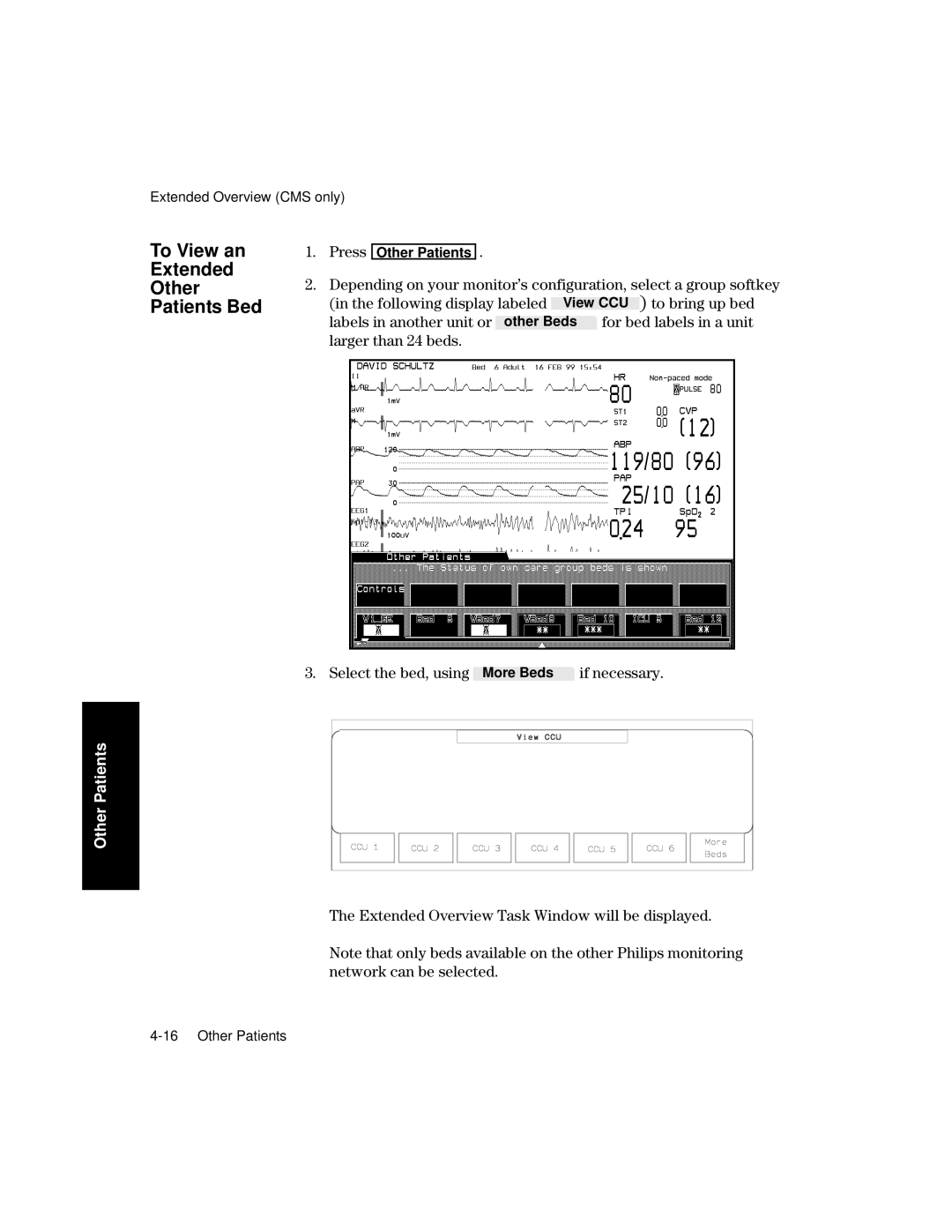 Philips V26CT, V24CT manual To View an Extended Other Patients Bed, Select the bed, using 