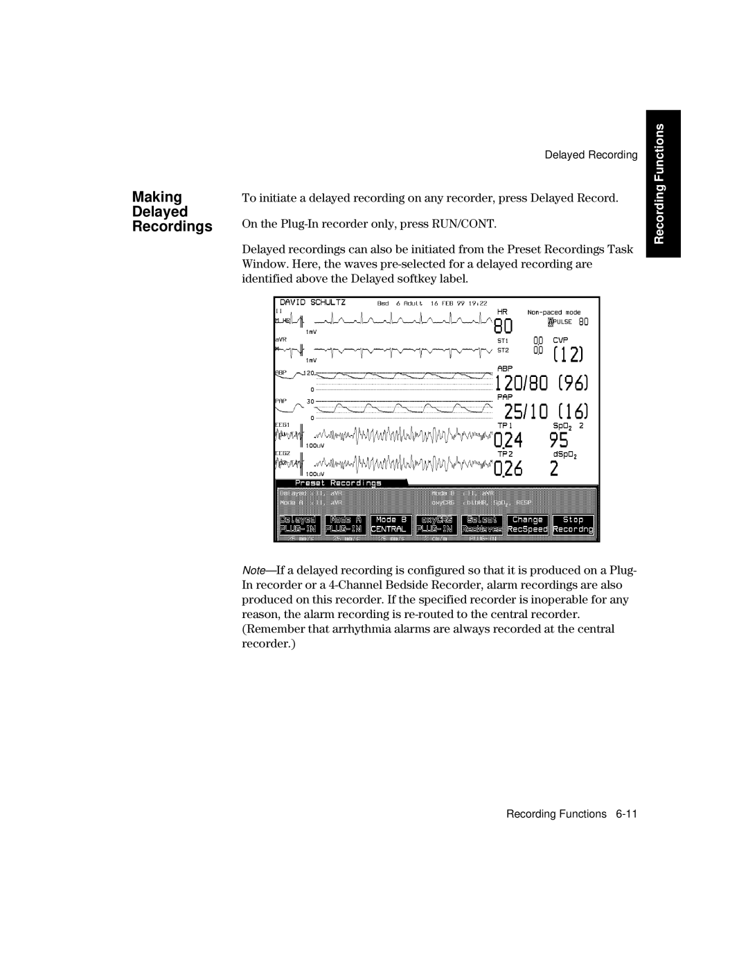 Philips V24CT, V26CT manual Making Delayed Recordings 