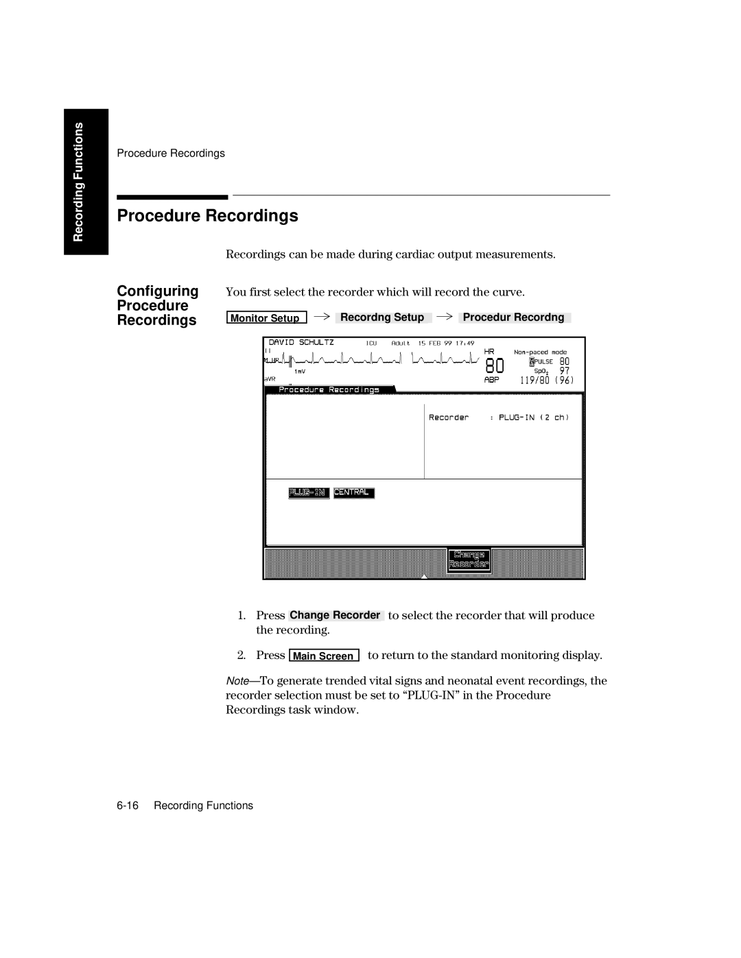 Philips V26CT, V24CT manual Procedure Recordings, Configuring, Recordings can be made during cardiac output measurements 